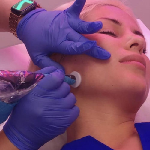 Procell treatment Procell treatment